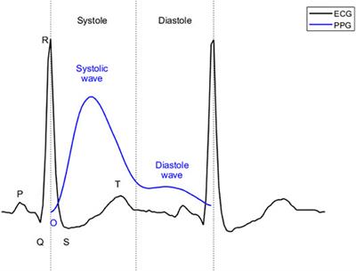 Robust Reconstruction of Electrocardiogram Using Photoplethysmography: A Subject-Based Model